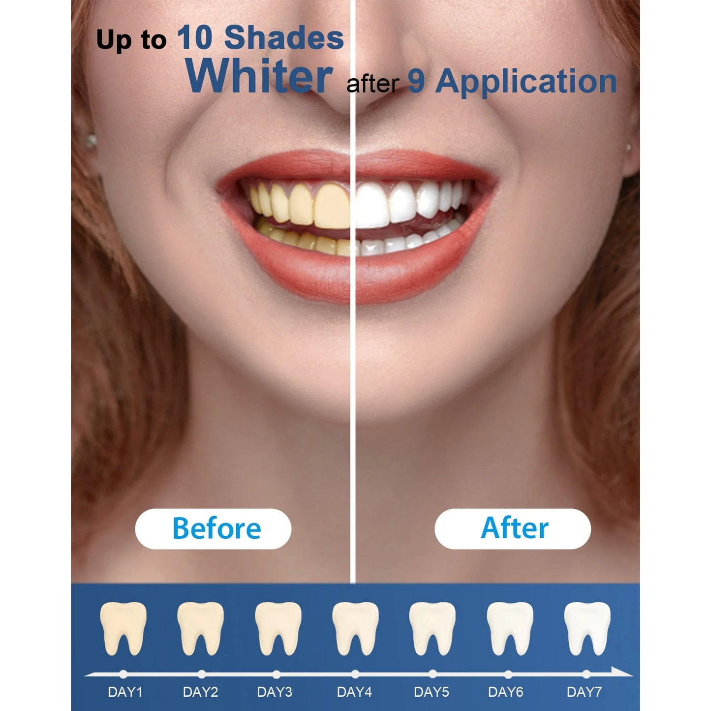 Teeth Whitening & Stain Remover Kit