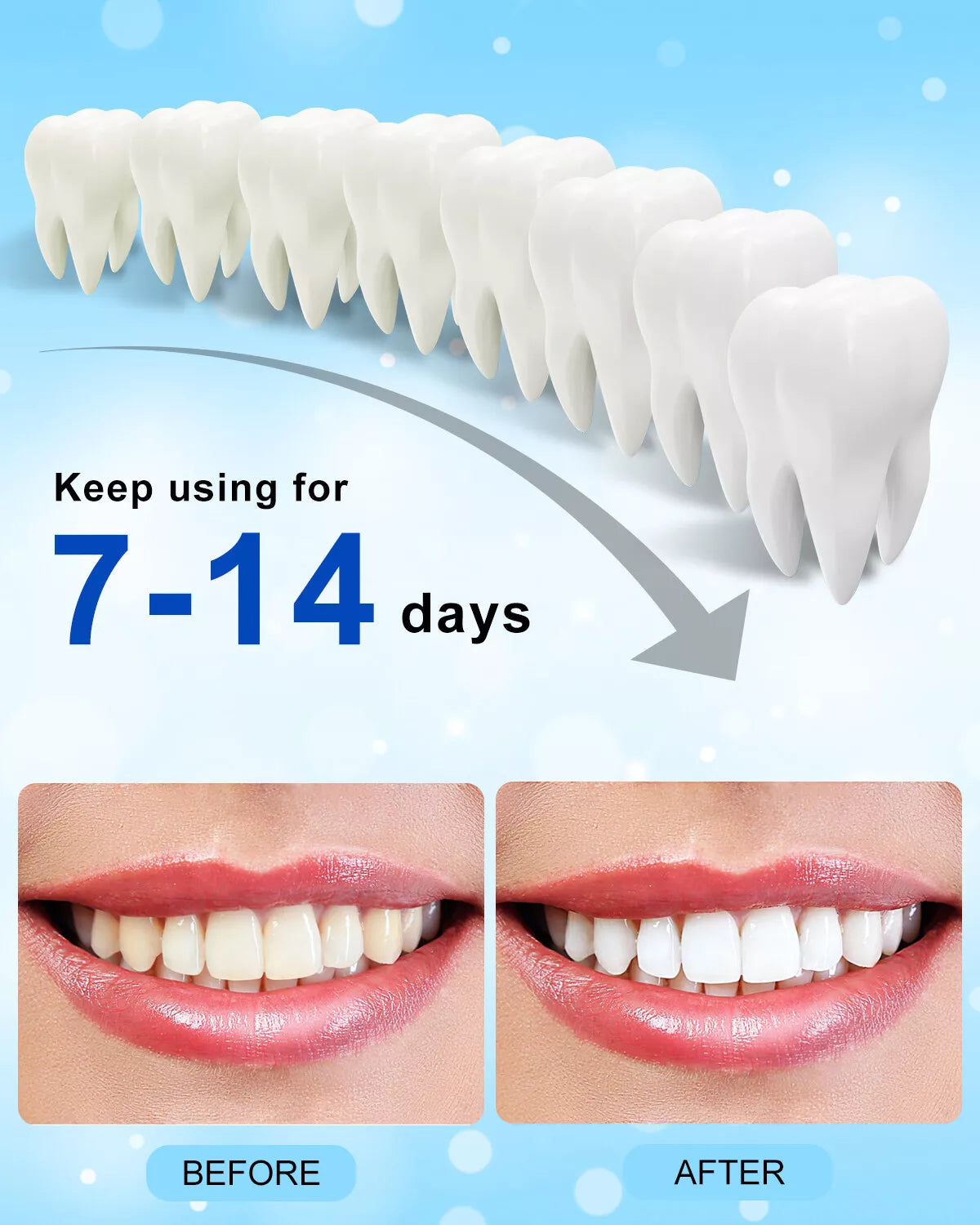 Teeth Whitening & Stain Remover Kit