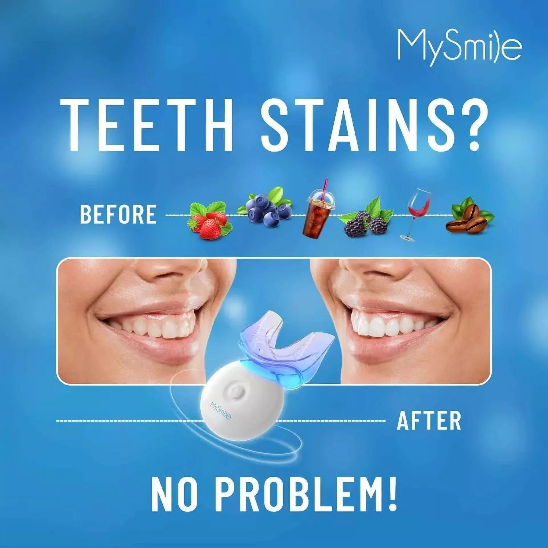 2PC Teeth Whitening Kit with 5-LED Light