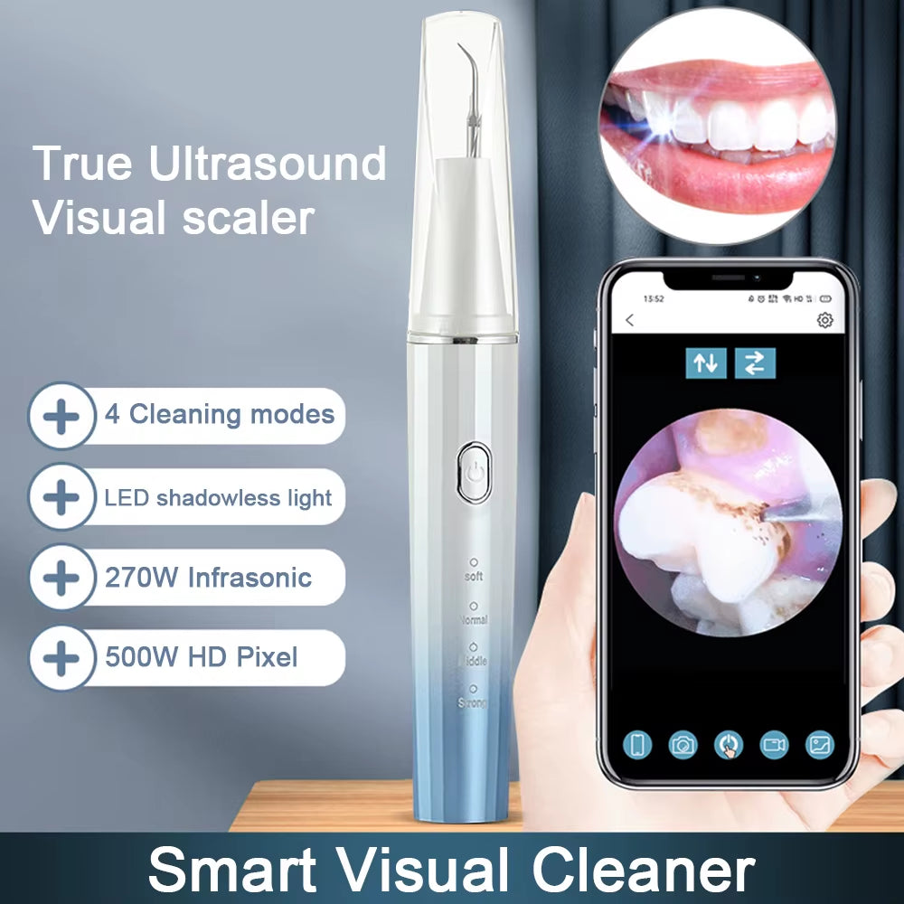 Visual Ultrasonic Stain Remover (with phone app)