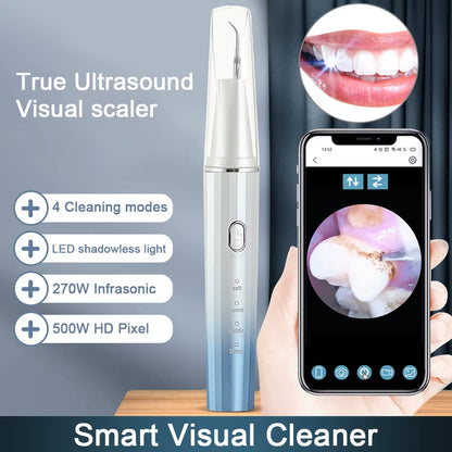 Visual Ultrasonic Stain Remover (with phone app)