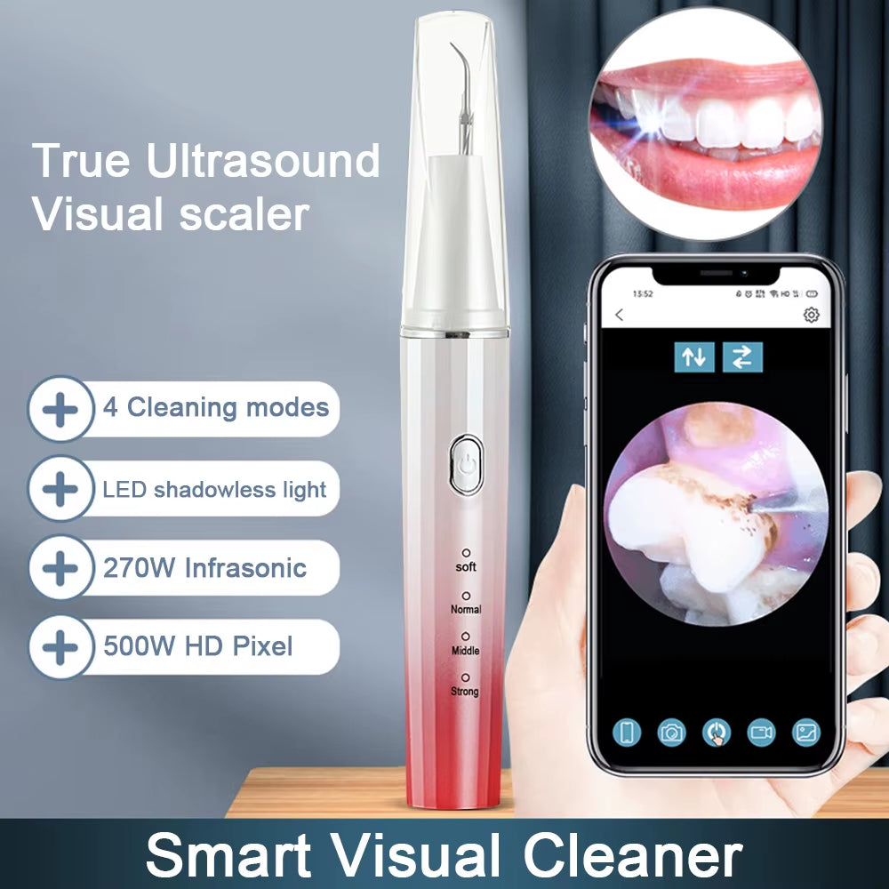 Visual Ultrasonic Stain Remover (with phone app)