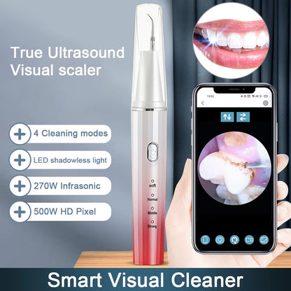 Visual Ultrasonic Stain Remover (with phone app)