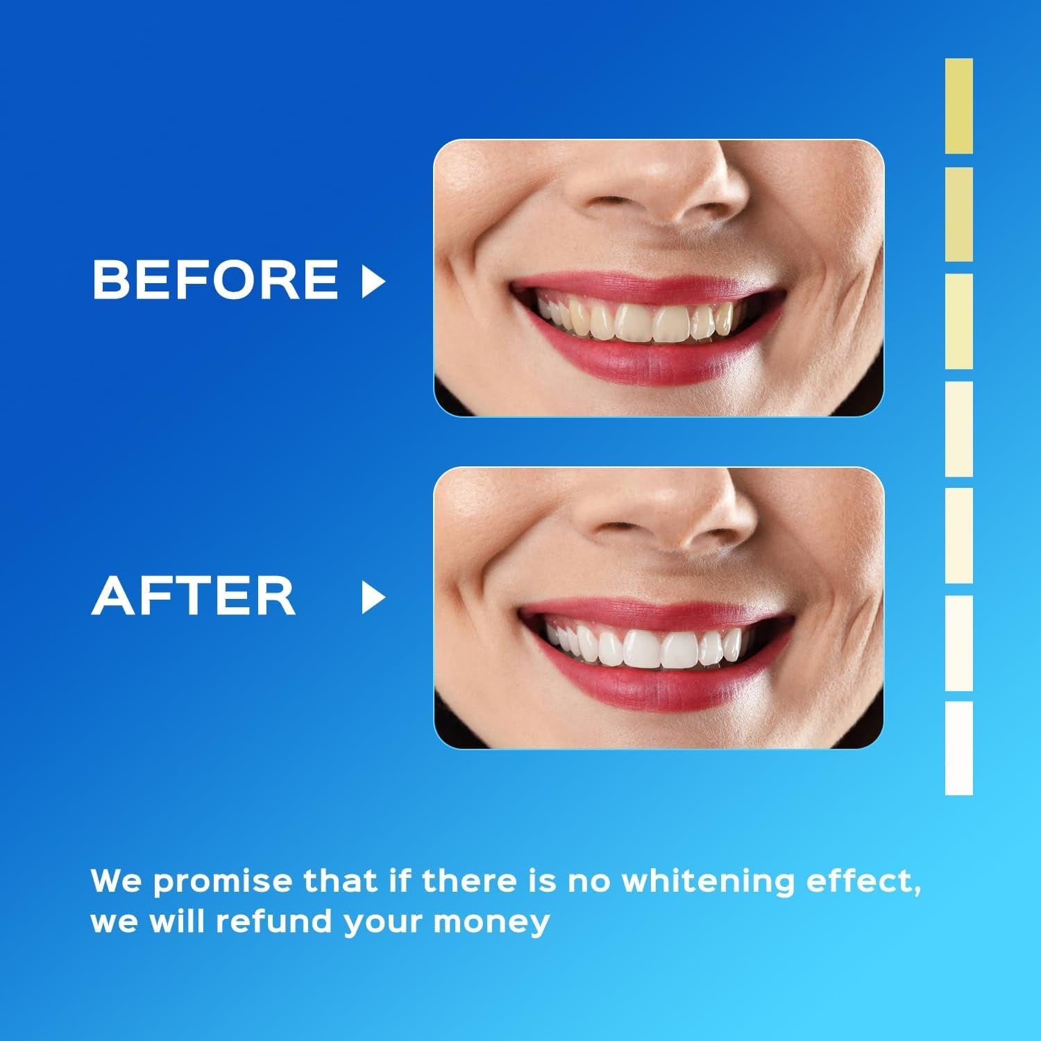  Rechargeable Teeth Whitener Gel Pen Strips