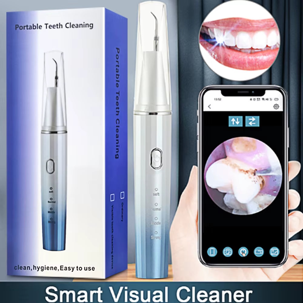 Visual Ultrasonic Stain Remover (with phone app)