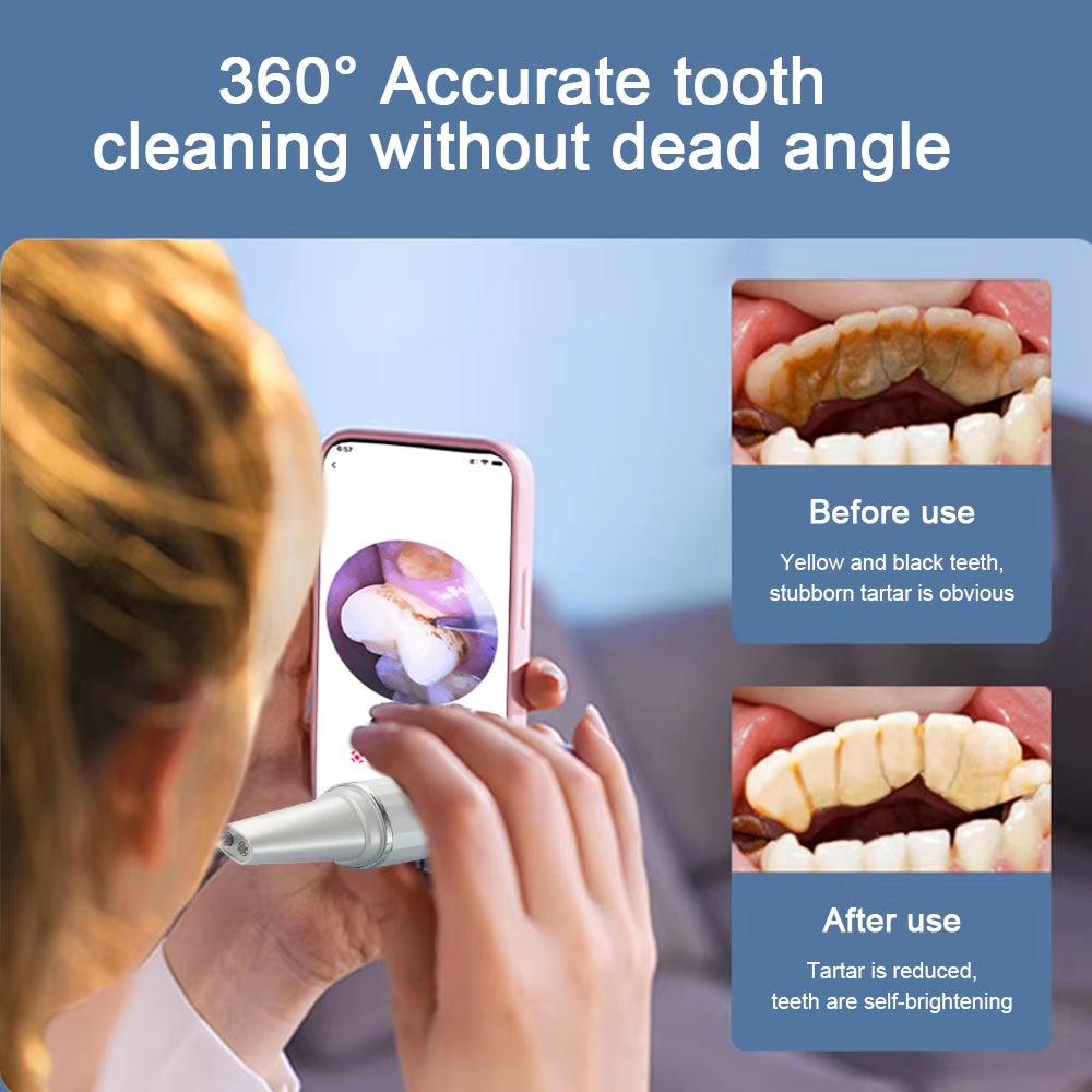 Visual Ultrasonic Stain Remover (with phone app)